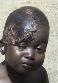 Nigeria – Boko Haram spinge la testa di un bambino nel fuoco perché non voleva lasciar bruciare la sua Bibbia